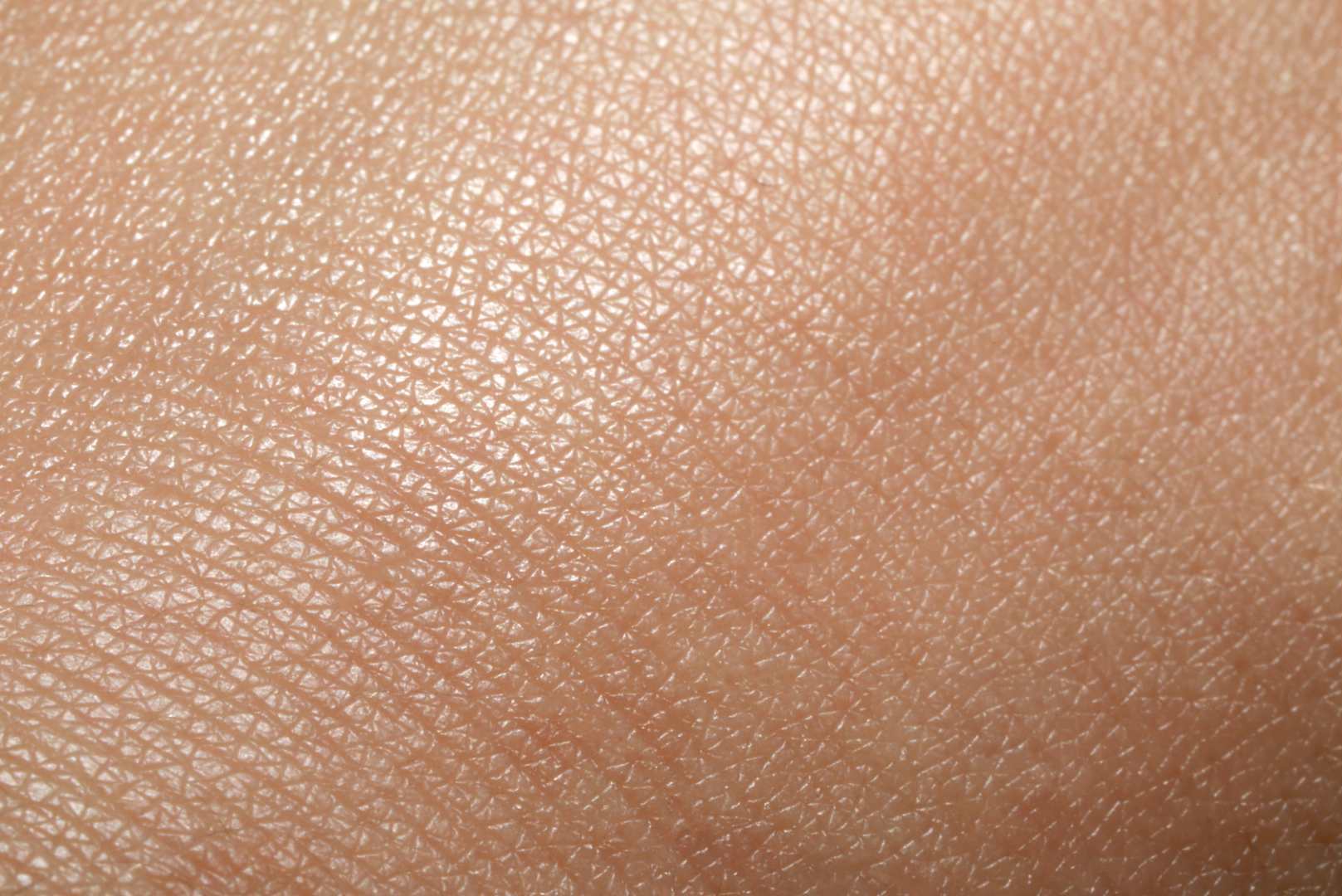 Identify your Skin Is Dehydrated