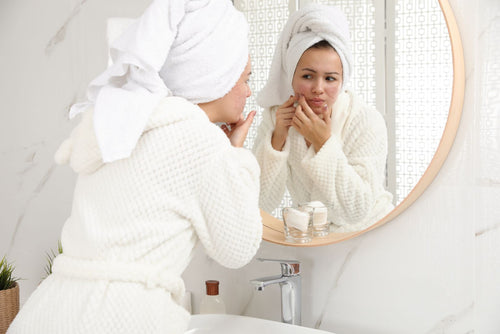 How To Prevent Acne Scars