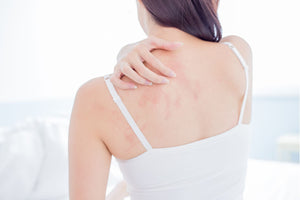 How to Tell If You Have Eczema or Psoriasis + How To Help Each