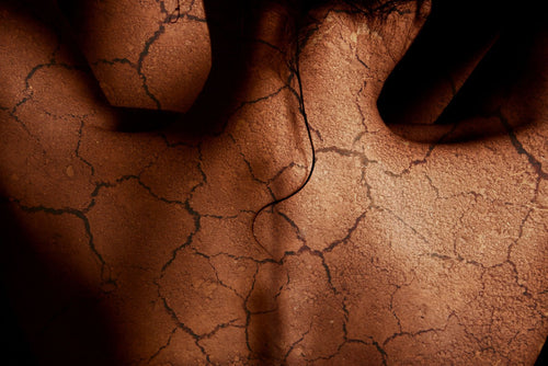 dry or dehydrated skin