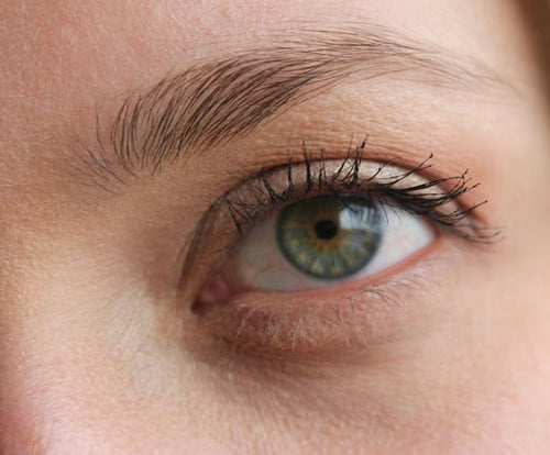 How to deal with Eyelid Eczema