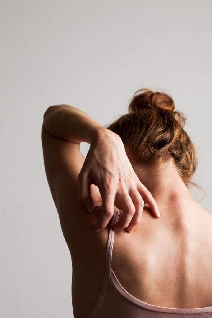 Relief From Eczema