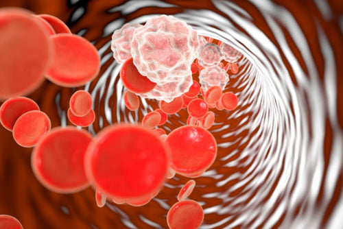 Signs Of Inflammation & How To Handle