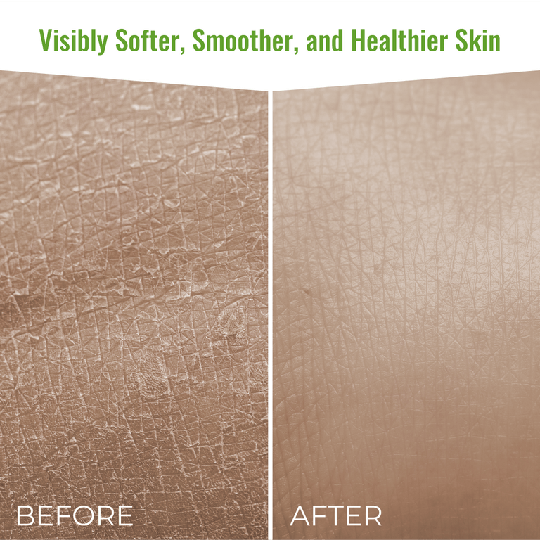 Wild Naturals Eczema & Psoriasis Body Wash 8 oz bottle – gentle, pH-balanced cleanser with aloe vera, Manuka honey, and vitamin E for soothing dry, itchy skin.